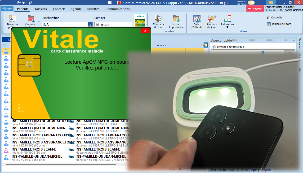 image ApCV